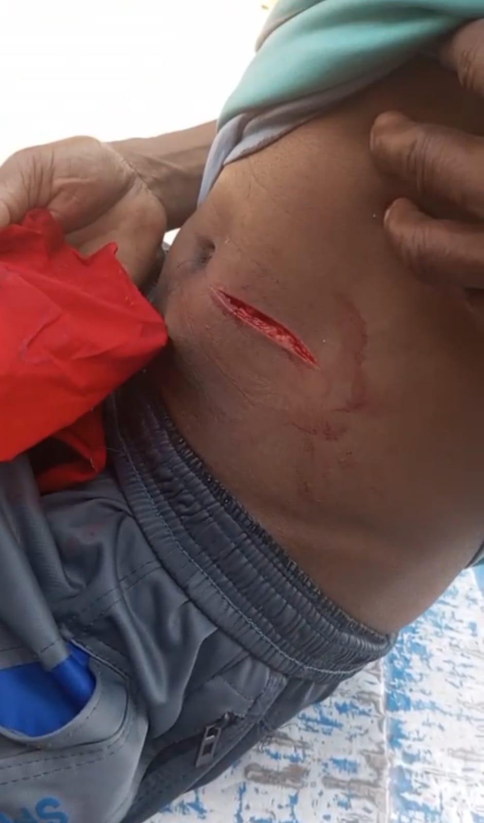 যশোর-২ আসনে, নাভারণ ইউনিয়নে বায়সা ভোট কেন্দ্রে জামায়াতের ভোটারকে পেটে ছুরিকাঘাত