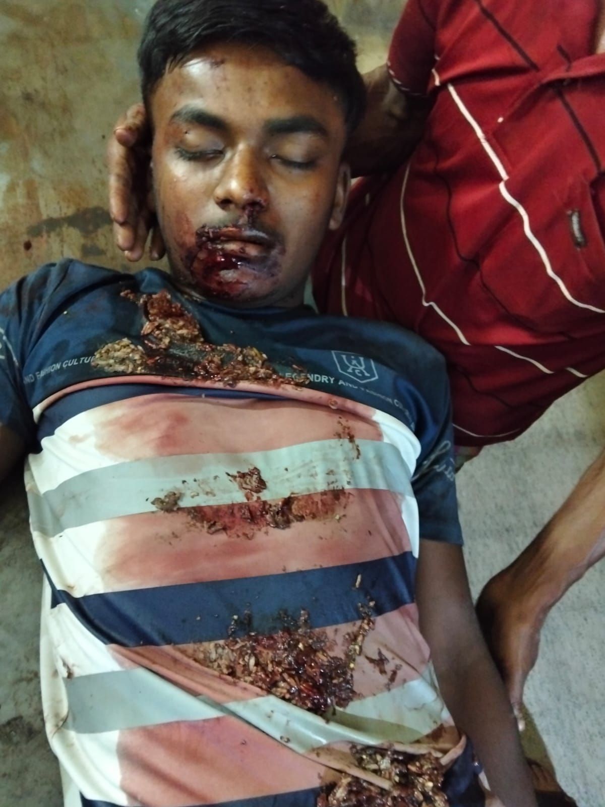 শার্শায় সড়ক দূর্ঘটনায় ০২ জন গুরুতর আহত