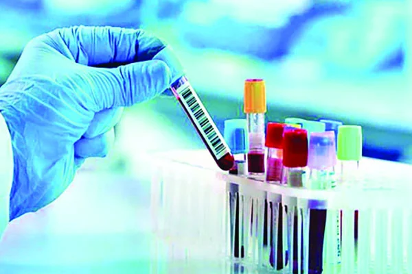 সকল চাকরিতেই এখন থেকে লাগবে ডোপ টেস্ট