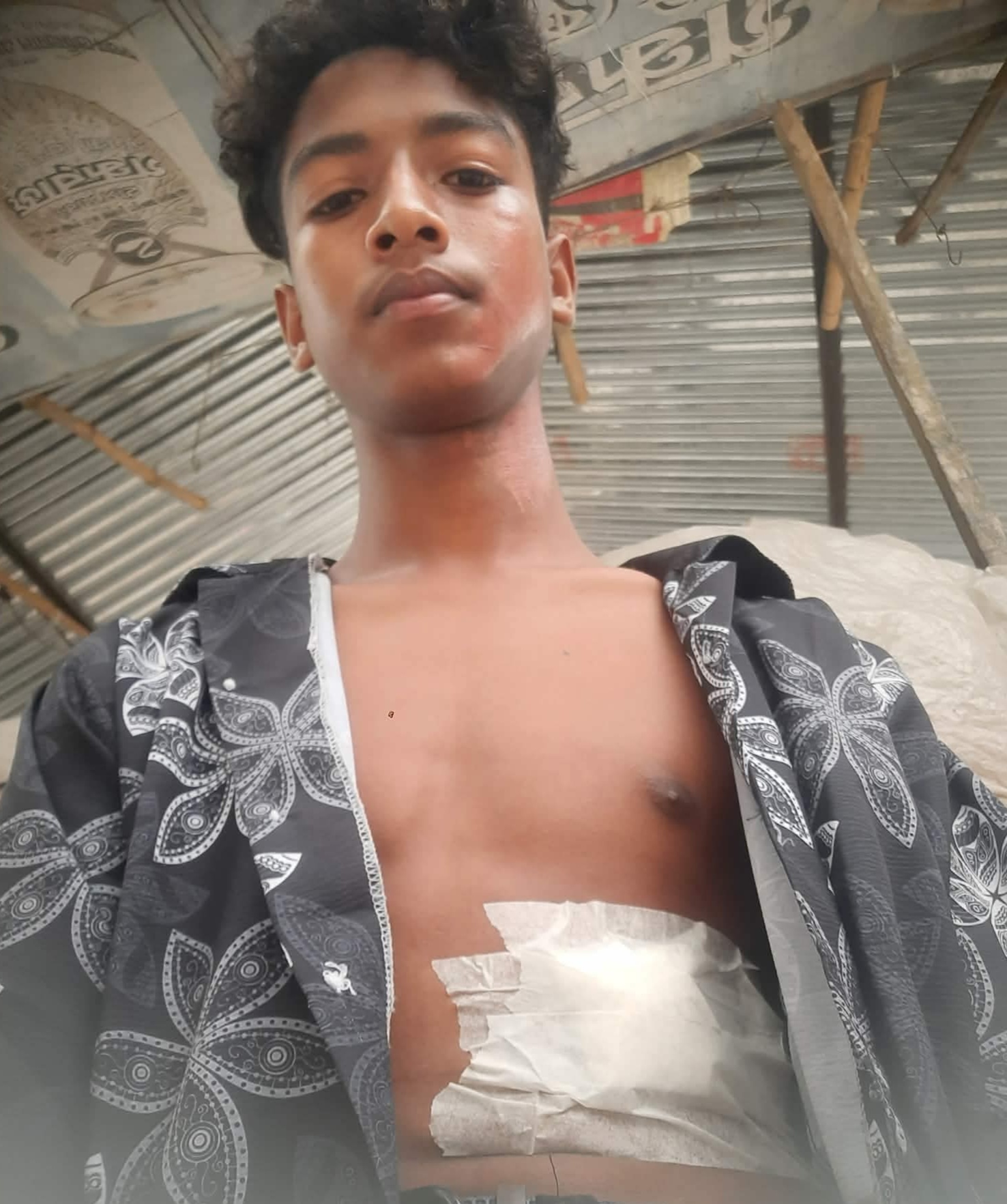 শার্শায় ফুটবল খেলাকে কেন্দ্র করে ছুরিকাঘাতে যুবক আহত
