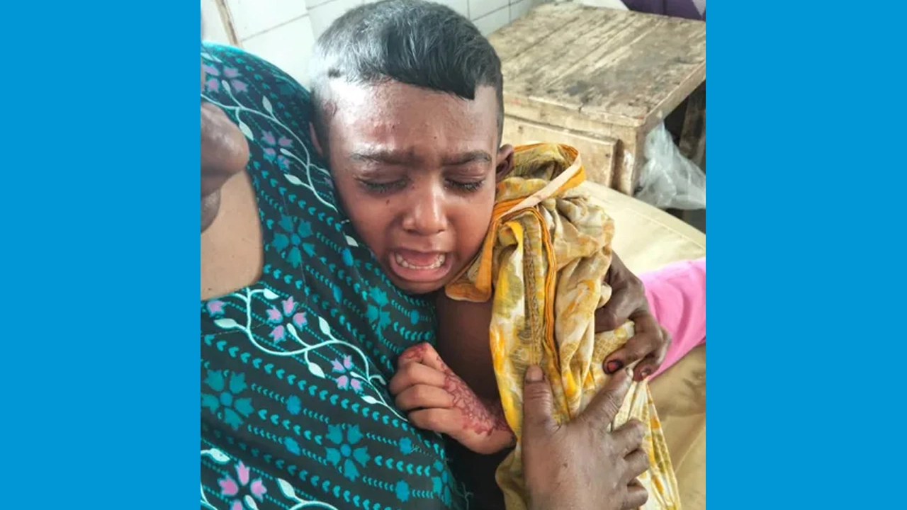 যশোরের ধর্মতলা এলাকায় পরিত্যক্ত বোমাবস্তু বিস্ফোরণে ২ শিশু গুরুতর আহত
